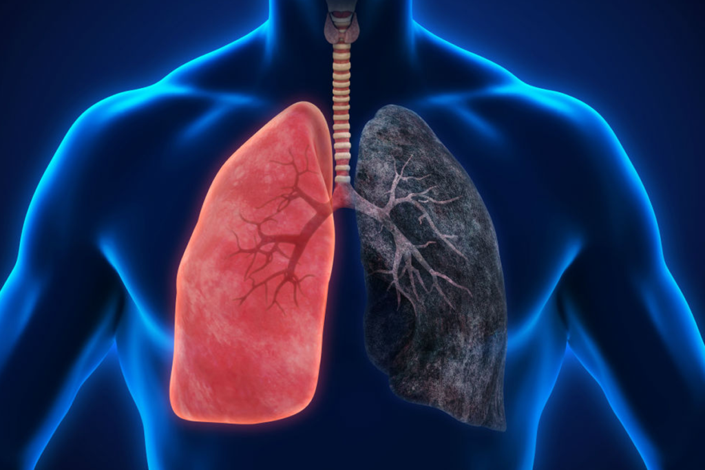 How Smoking Cigarettes Affects Your Lungs